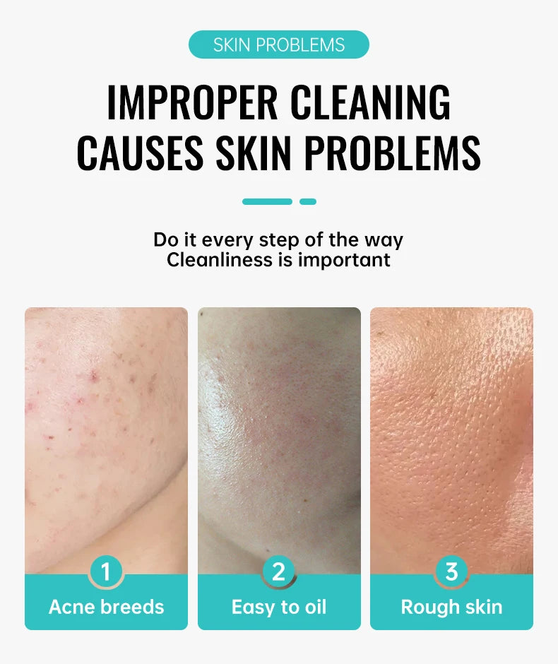 Salicylic Acid Acne Reduce Face Cream Faded Pimple Spots Deep Cleaning Pore Acne Scar Oil Control Moisturizing Skincare Product