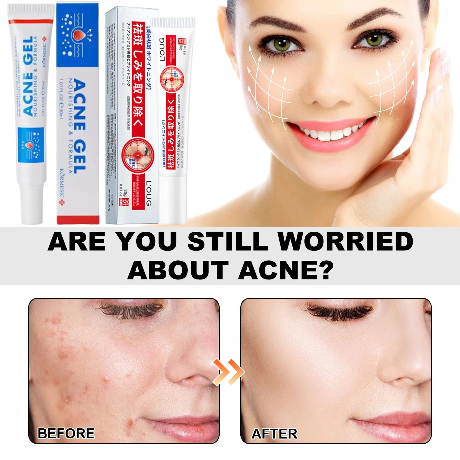 Salicylic Acid Acne Reduce Face Cream Faded Pimple Spots Deep Cleaning Pore Acne Scar Oil Control Moisturizing Skincare Product