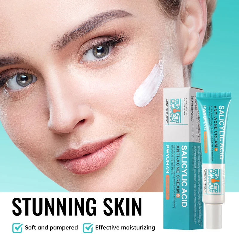 Salicylic Acid Acne Reduce Face Cream Faded Pimple Spots Deep Cleaning Pore Acne Scar Oil Control Moisturizing Skincare Product