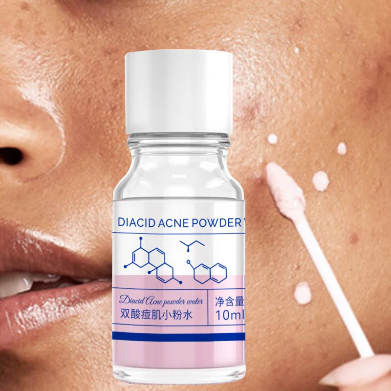 10ml pink salicylic acid concentrated acne essence - containing salicylic acid, lactose acid, calamine, double acid dual care, s