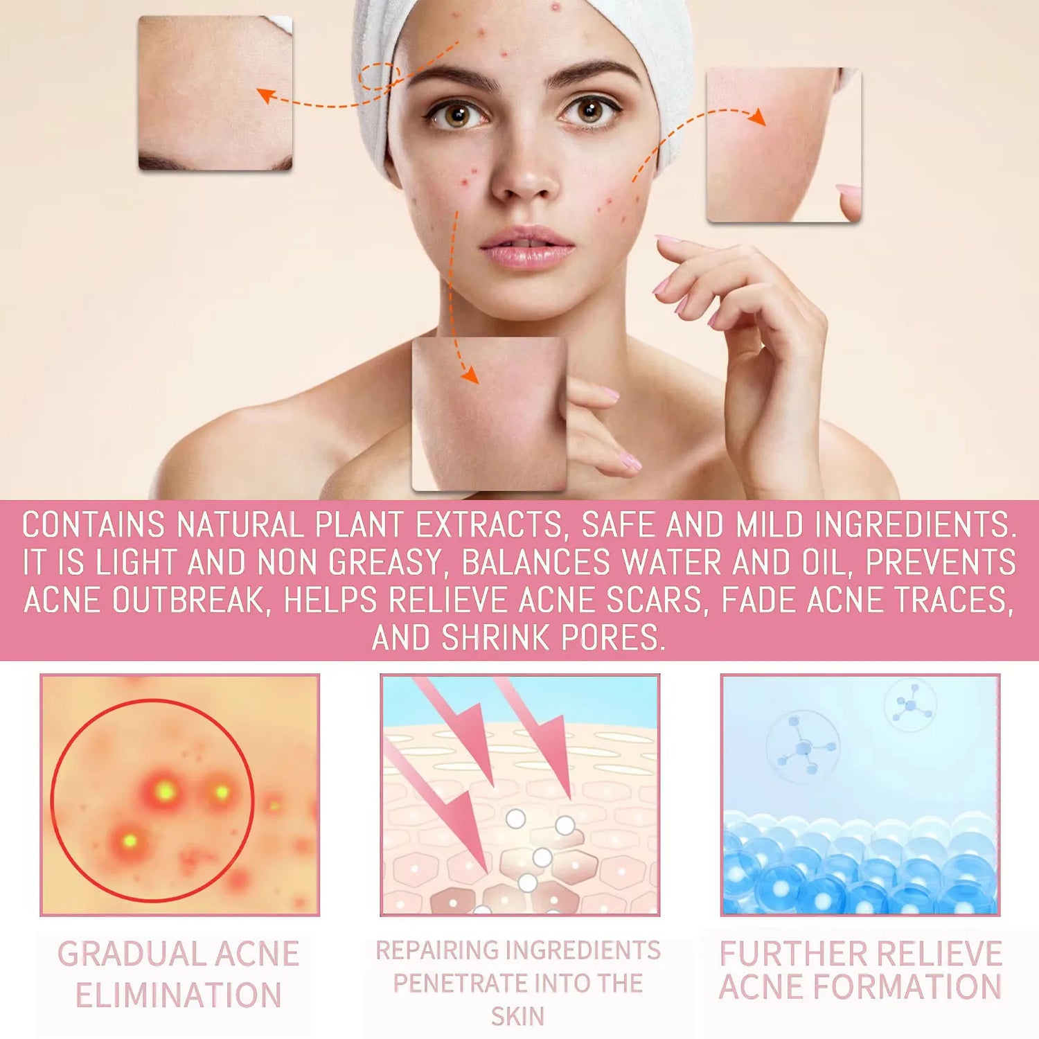 Salicylic Acid Acne Reduce Face Cream Faded Pimple Spots Deep Cleaning Pore Acne Scar Oil Control Moisturizing Skincare Product
