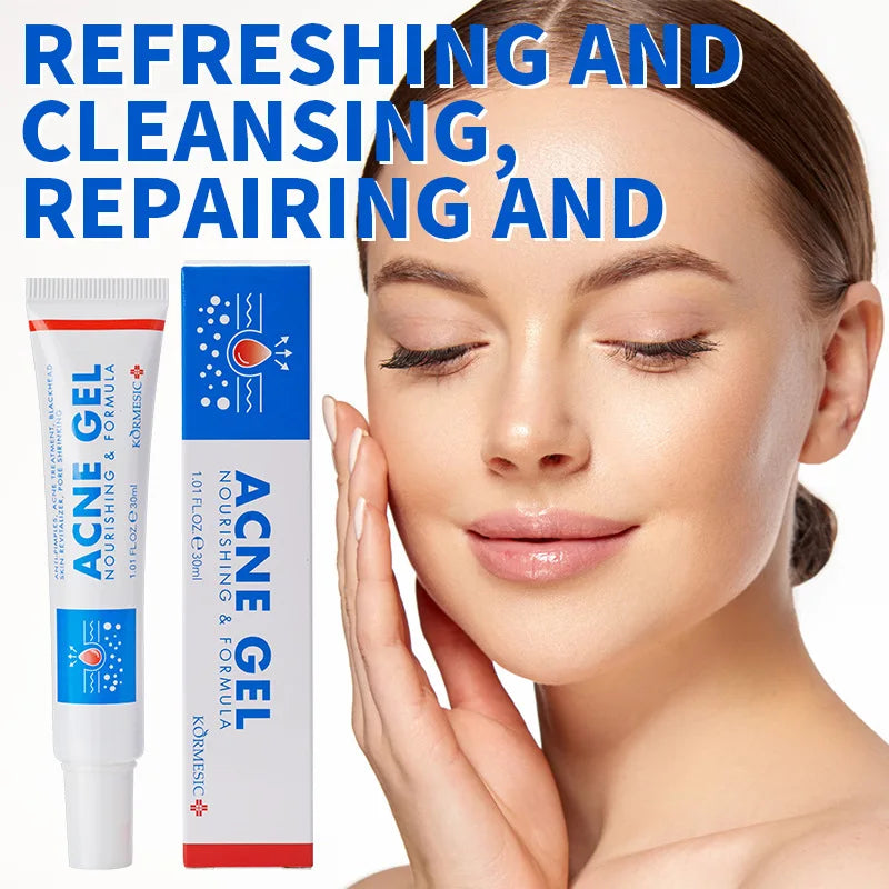 Salicylic Acid Acne Reduce Face Cream Faded Pimple Spots Deep Cleaning Pore Acne Scar Oil Control Moisturizing Skincare Product