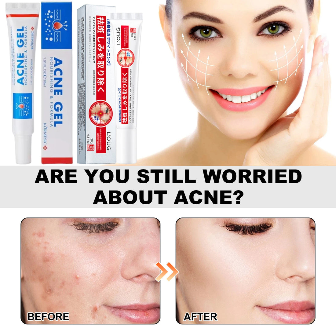 Salicylic Acid Acne Reduce Face Cream Faded Pimple Spots Deep Cleaning Pore Acne Scar Oil Control Moisturizing Skincare Product